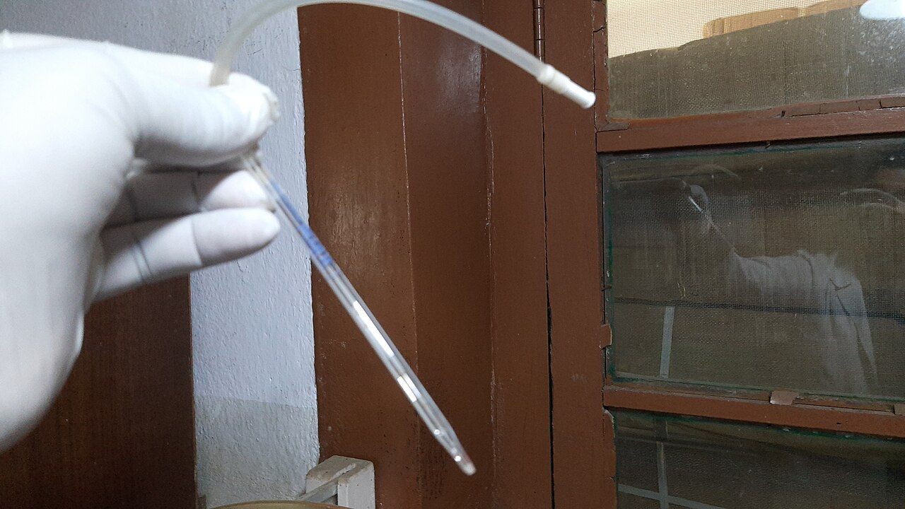 Pipette in der Hand mit Laborhandschuh